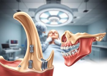 orthognathic surgery